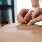 Acupuncture may reduce menopause symptoms