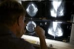 Breast cancer risk from menopause hormones may last decades – Washington Times