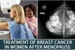 Treatment of Breast Cancer in Women after Menopause