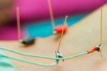 Acupuncture For Menopause – Everything You Need To Know