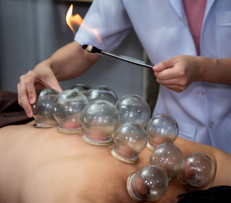 How to Find a Reliable Acupuncturist