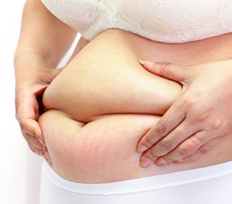 Menopause Bloating- Causes, Treatment fat