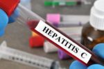 Effects Of Hepatitis C Virus Infection On Menopausal Women And Symptoms