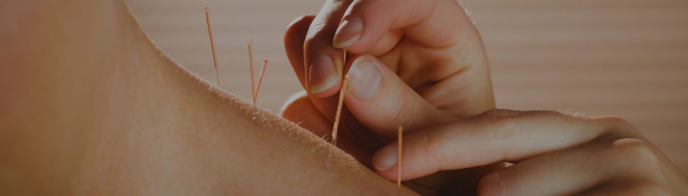 acupuncture sarasota bg