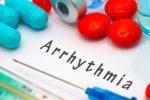 Arrhythmia and Menopause – Everything You Need To Know