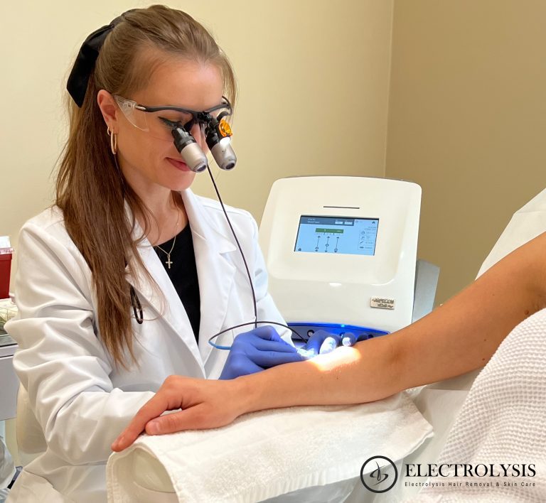 Electrolysis hair removal Arlington Heights 768x708