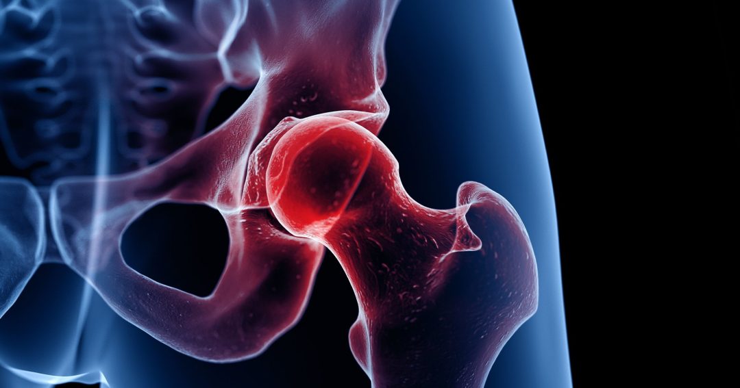 Menopause Bone Loss PE 1796x943 1080x567